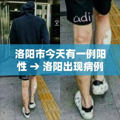 洛阳市今天有一例阳性 → 洛阳出现病例了么