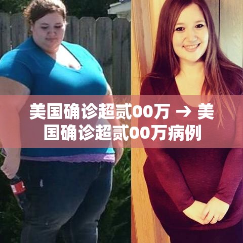 美国确诊超贰00万 → 美国确诊超贰00万病例