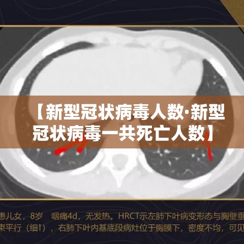 【新型冠状病毒人数·新型冠状病毒一共死亡人数】